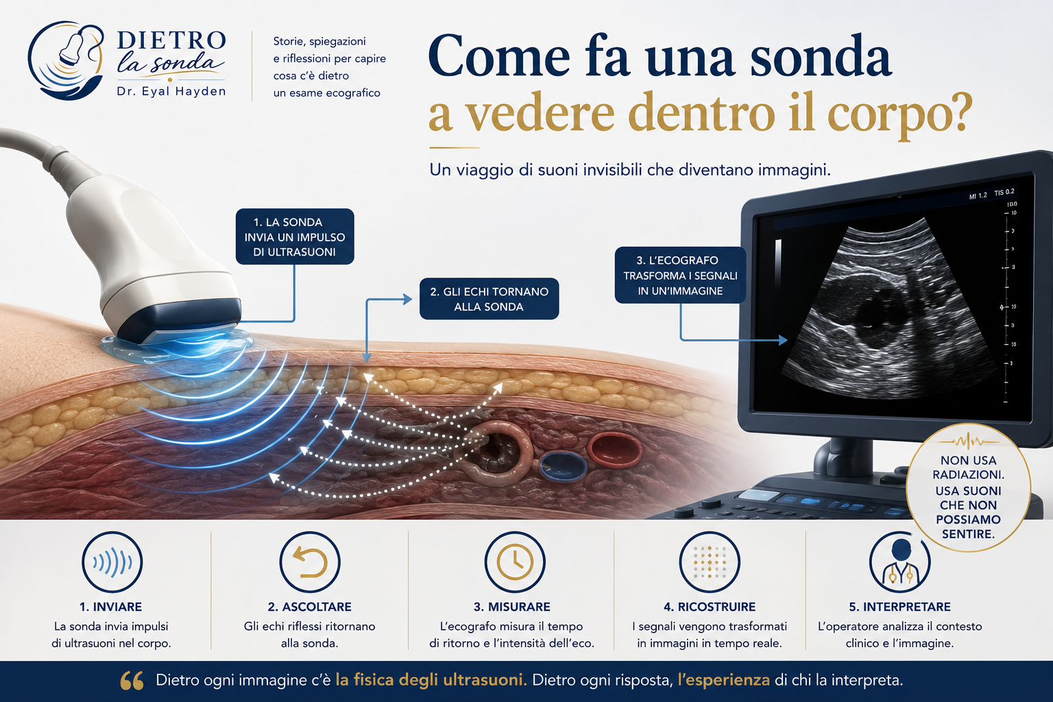 La sonda invia ultrasuoni e gli echi costruiscono l immagine ecografica
